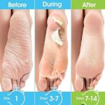 ماسک پا اسکین لایت عصاره پاپایا - Image 2