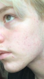 بعد از استفاده از اسنس گالاکتومایسس کوزارکس