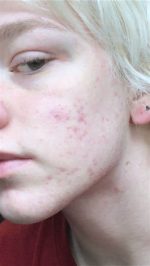 قبل از استفاده از اسنس گالاکتومایسس کوزارکس