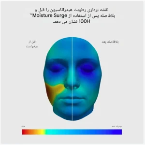 مقایسه حالت صورت در شرایط قبل و بعد از استفاده از آبرسان کلینیک