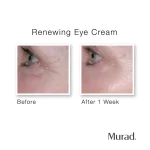 کرم دورچشم دکتر مورد | Murad Renewing Eye Cream 15 ml - Image 2