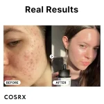سرم نیاسینامید 15 کوزارکس | COSRX Niacinamide 15 - Image 2