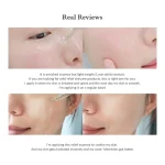 اسنس تسکین دهنده و ضدالتهاب پوست حساس دکتر آلتیا DR.ALTHEA SKIN RELIEF ESSENCE 30 ml - Image 2