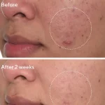 سرم ضد لک فوری دکتر مورد | Murad Rapid Dark Spot Correcting Serum 30 ml - Image 5