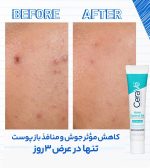 ژل ضد جوش سراوی CERAVE ACNE CONTROL GEL حجم40ml اصل آمریکا - Image 2
