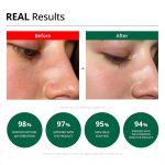 کرم تسکین‌دهنده و شفاف‌کننده لکه‌های قرمز دکتر جی | Dr.G Red Blemish Clear Soothing Cream    - Image 2