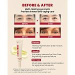 کرم دور چشم سئول 1988 رتینال لیپوزومی و لوبیا کی سکرت K-Secret - Image 2